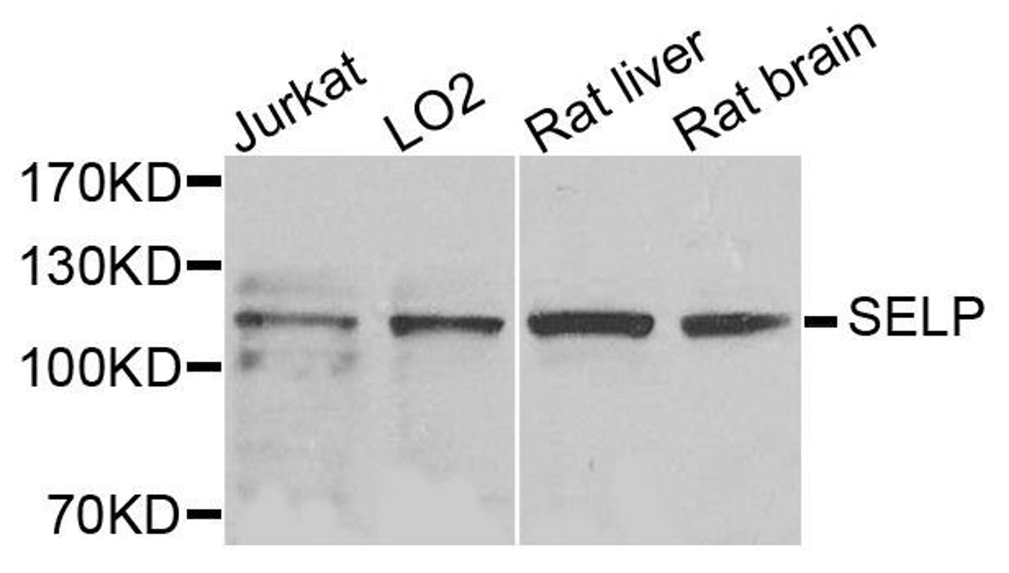 Western blot analysis of extracts of various cells using SELP antibody