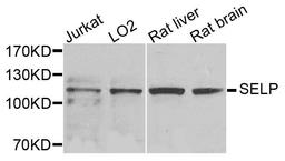 Western blot analysis of extracts of various cells using SELP antibody