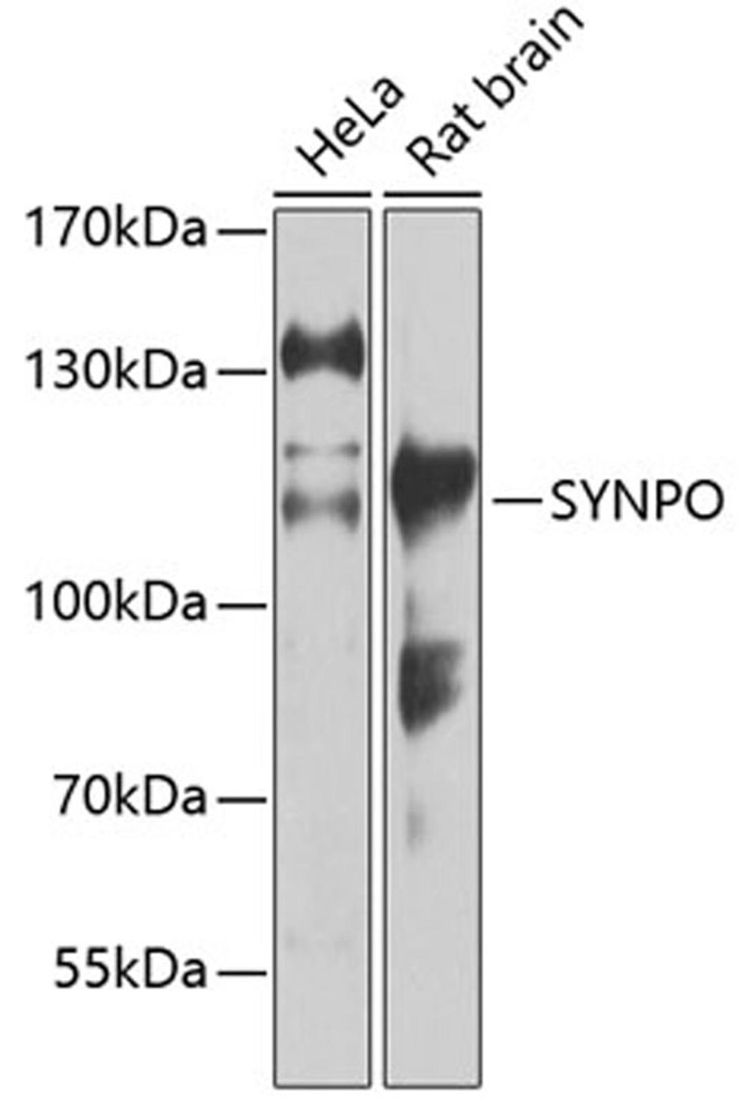 Western blot - SYNPO antibody (A12049)