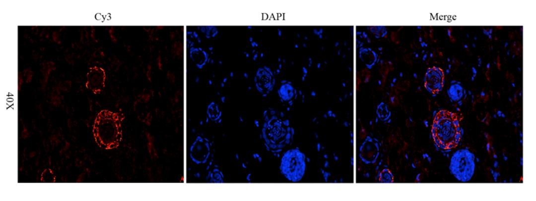 Immunofluorescence image of rat skin tissue using anti-MCP1 (dilution at 1:200)