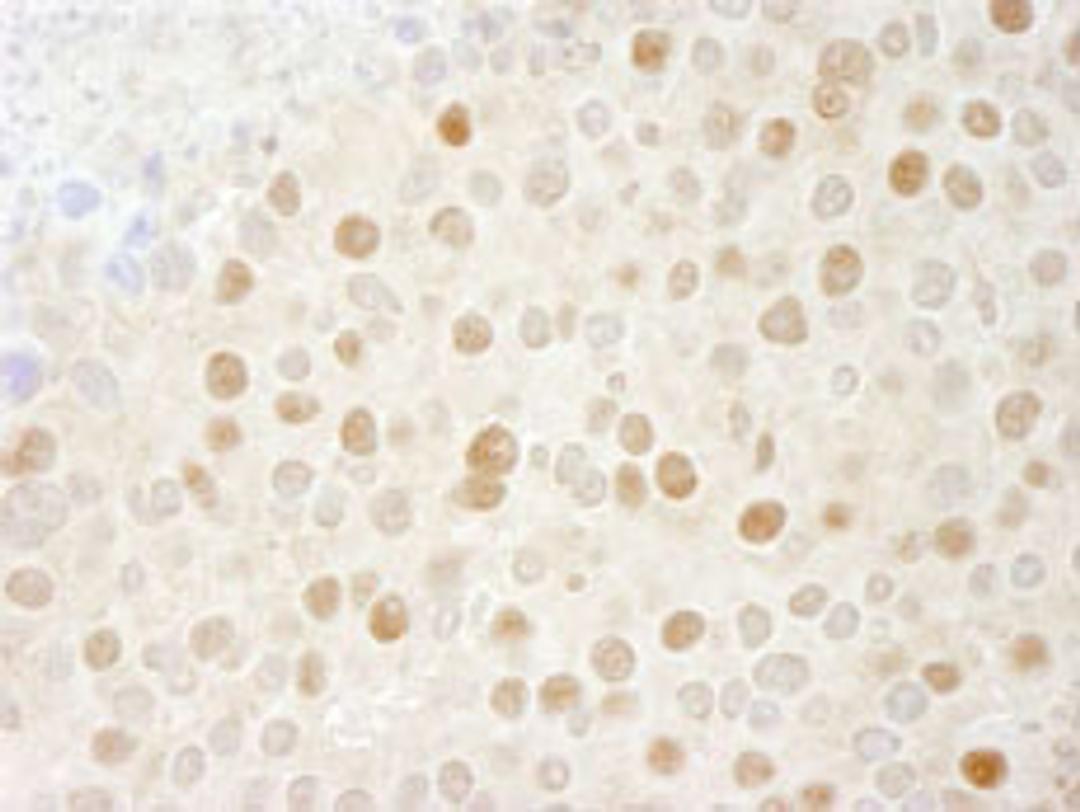 Detection of mouse CDK2 by immunohistochemistry.