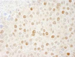 Detection of mouse CDK2 by immunohistochemistry.