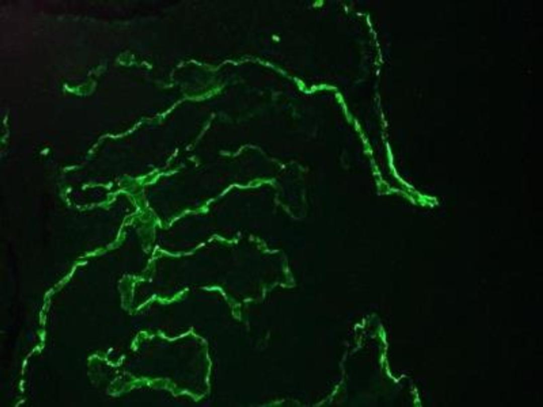 Immunocytochemistry/Immunofluorescence: Cytokeratin 10 Antibody (RKSE 60) [NBP1-97795] - Immunofluorescence staining of a 7 days old zebrafish embryo