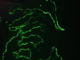 Immunocytochemistry/Immunofluorescence: Cytokeratin 10 Antibody (RKSE 60) [NBP1-97795] - Immunofluorescence staining of a 7 days old zebrafish embryo