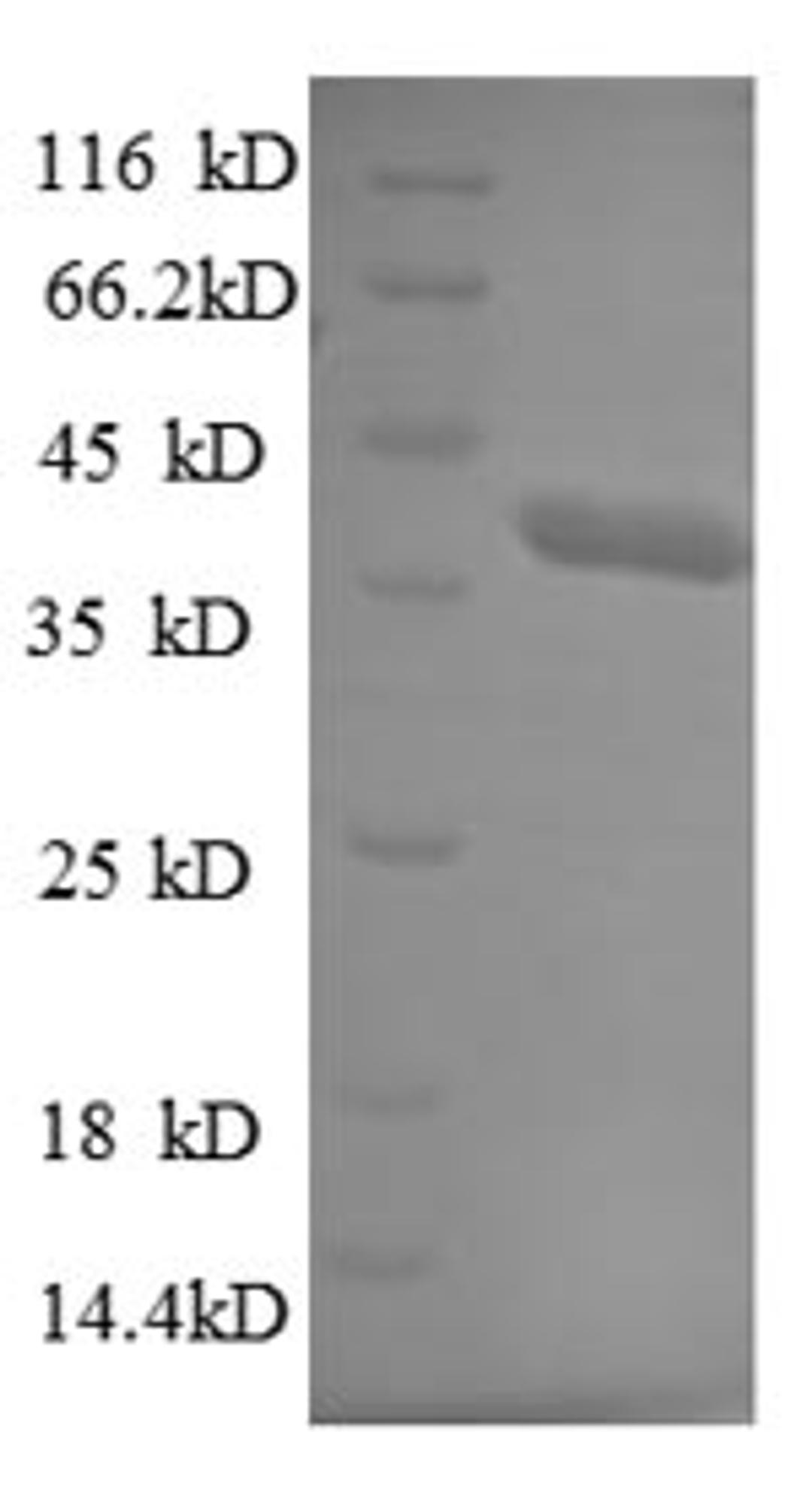 (Tris-Glycine gel) Discontinuous SDS-PAGE (reduced) with 5% enrichment gel and 15% separation gel.