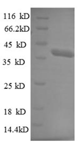 (Tris-Glycine gel) Discontinuous SDS-PAGE (reduced) with 5% enrichment gel and 15% separation gel.