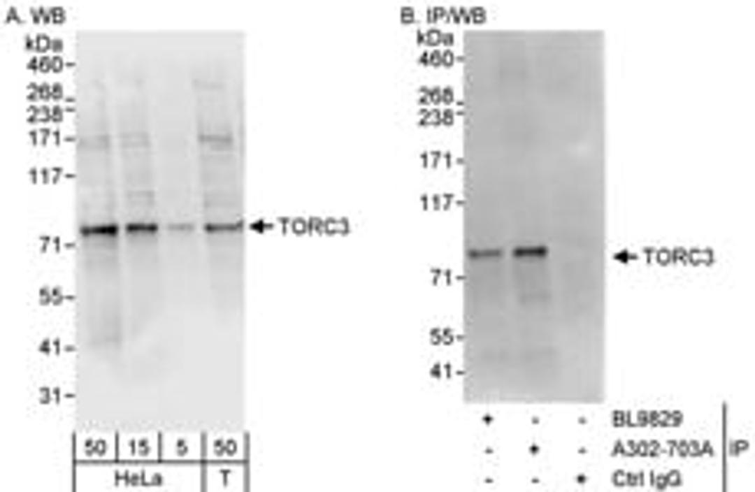 Detection of human TORC3 by western blot and immunoprecipitation.