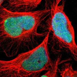 Immunocytochemistry/Immunofluorescence: C1orf174 Antibody [NBP1-87116] - Staining of human cell line U-2 OS shows positivity in nuclei.