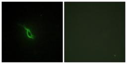 Immunocytochemistry/Immunofluorescence: Alpha 2a Adrenergic Receptor Antibody [NBP1-67832] - Analysis of NIH-3T3 cells, using Alpha 2a Adrenergic Receptor Antibody. The picture on the right is treated with the synthesized peptide.