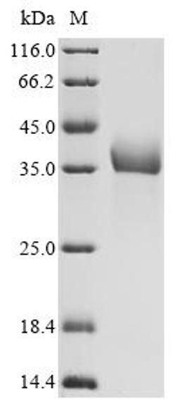 (Tris-Glycine gel) Discontinuous SDS-PAGE (reduced) with 5% enrichment gel and 15% separation gel.