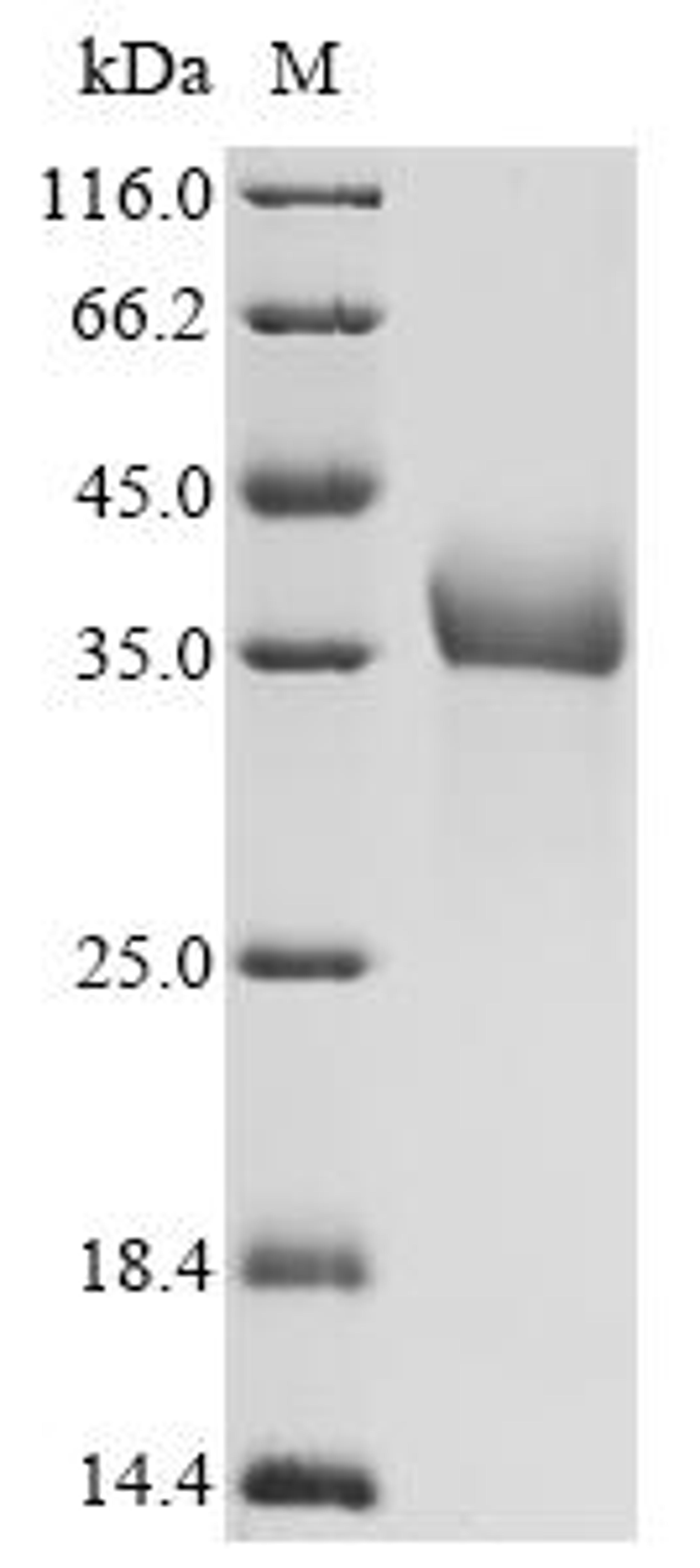 (Tris-Glycine gel) Discontinuous SDS-PAGE (reduced) with 5% enrichment gel and 15% separation gel.