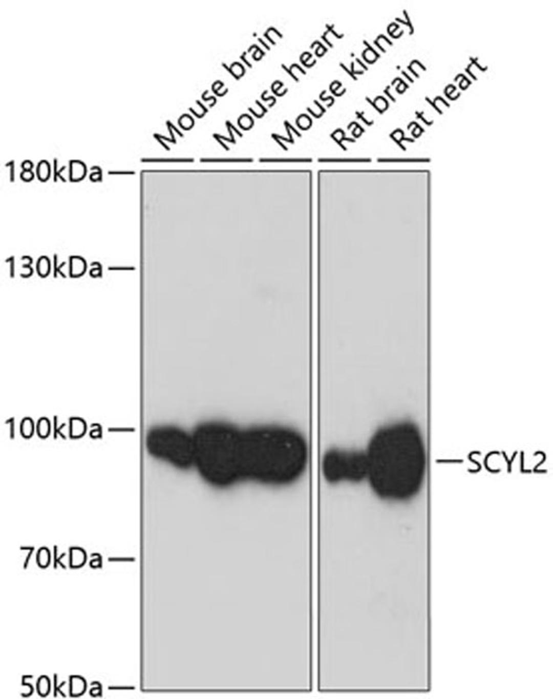 Western blot - SCYL2 antibody (A13178)