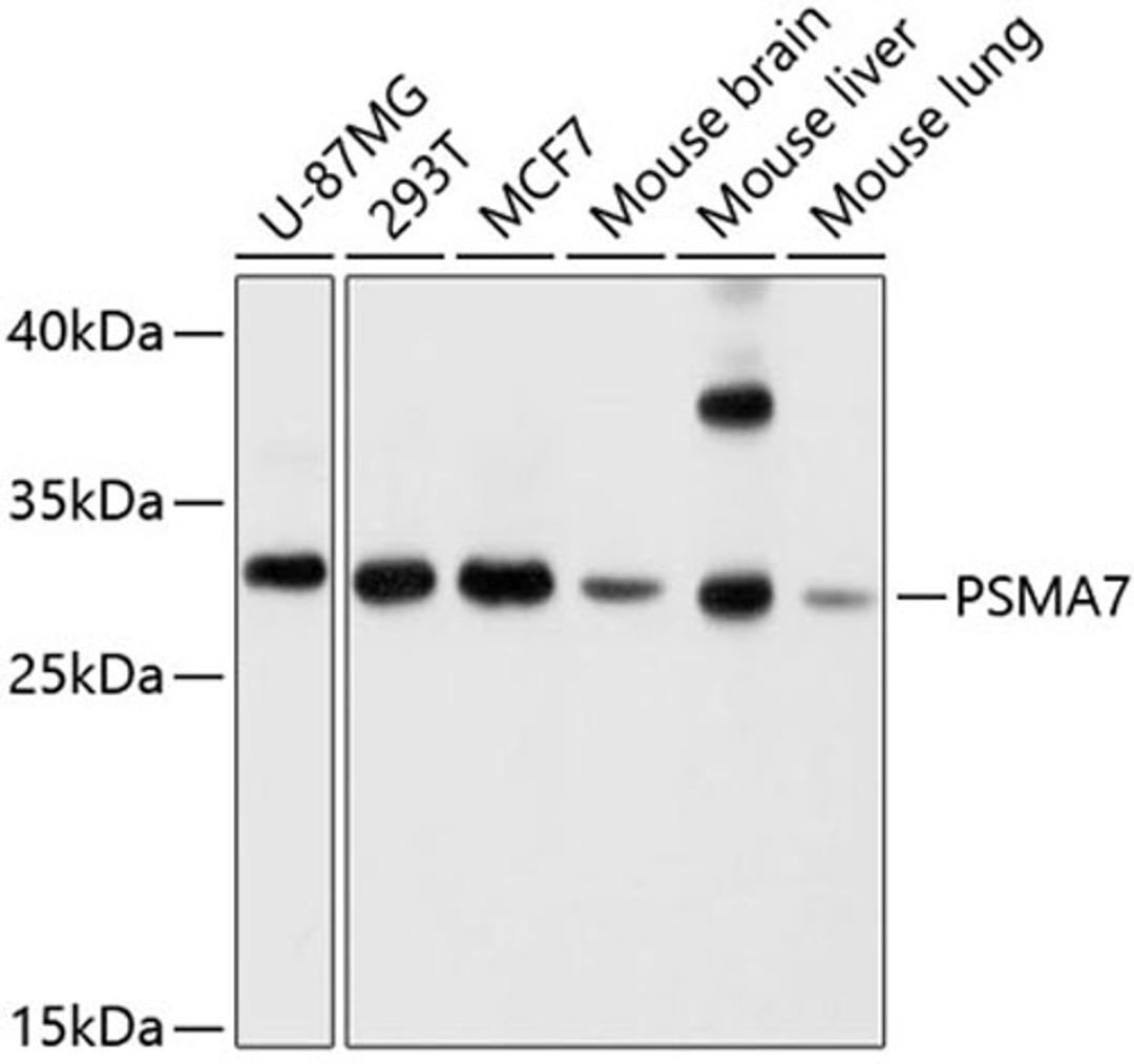 Western blot - PSMA7 antibody (A4052)