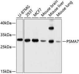 Western blot - PSMA7 antibody (A4052)