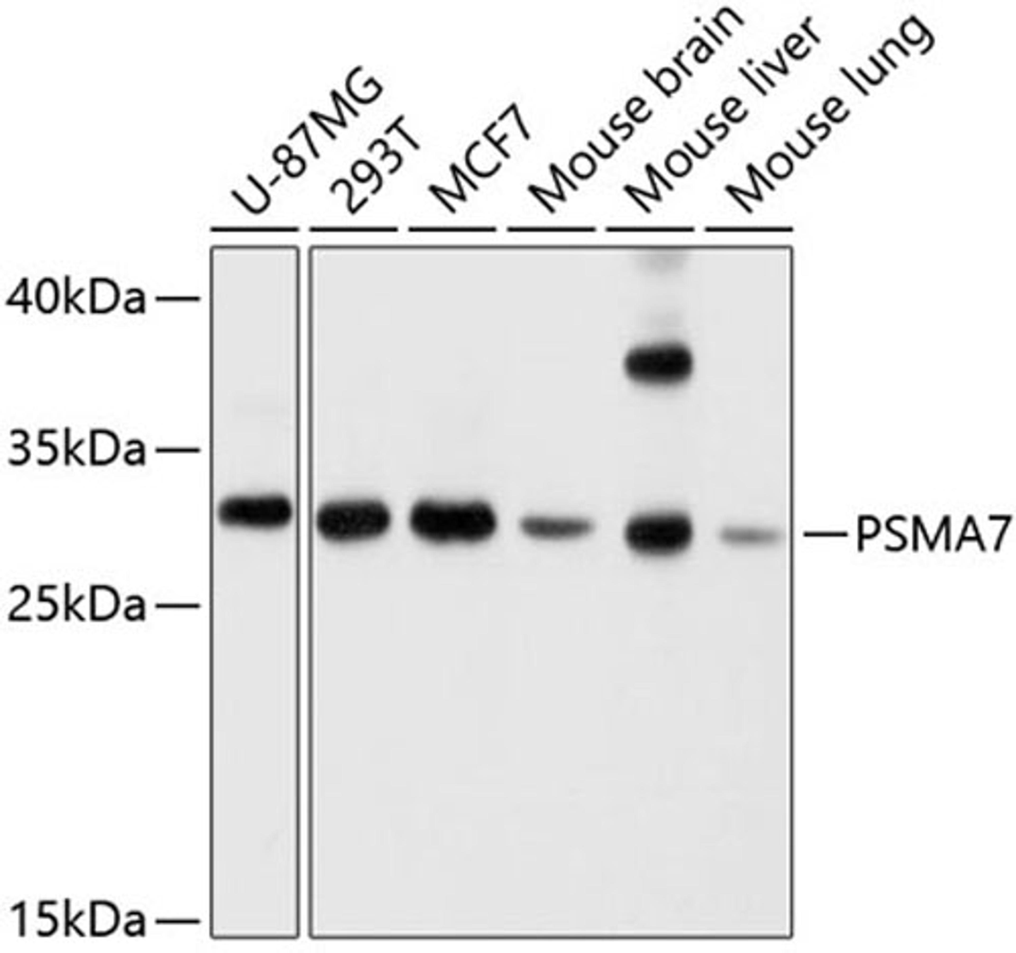 Western blot - PSMA7 antibody (A4052)