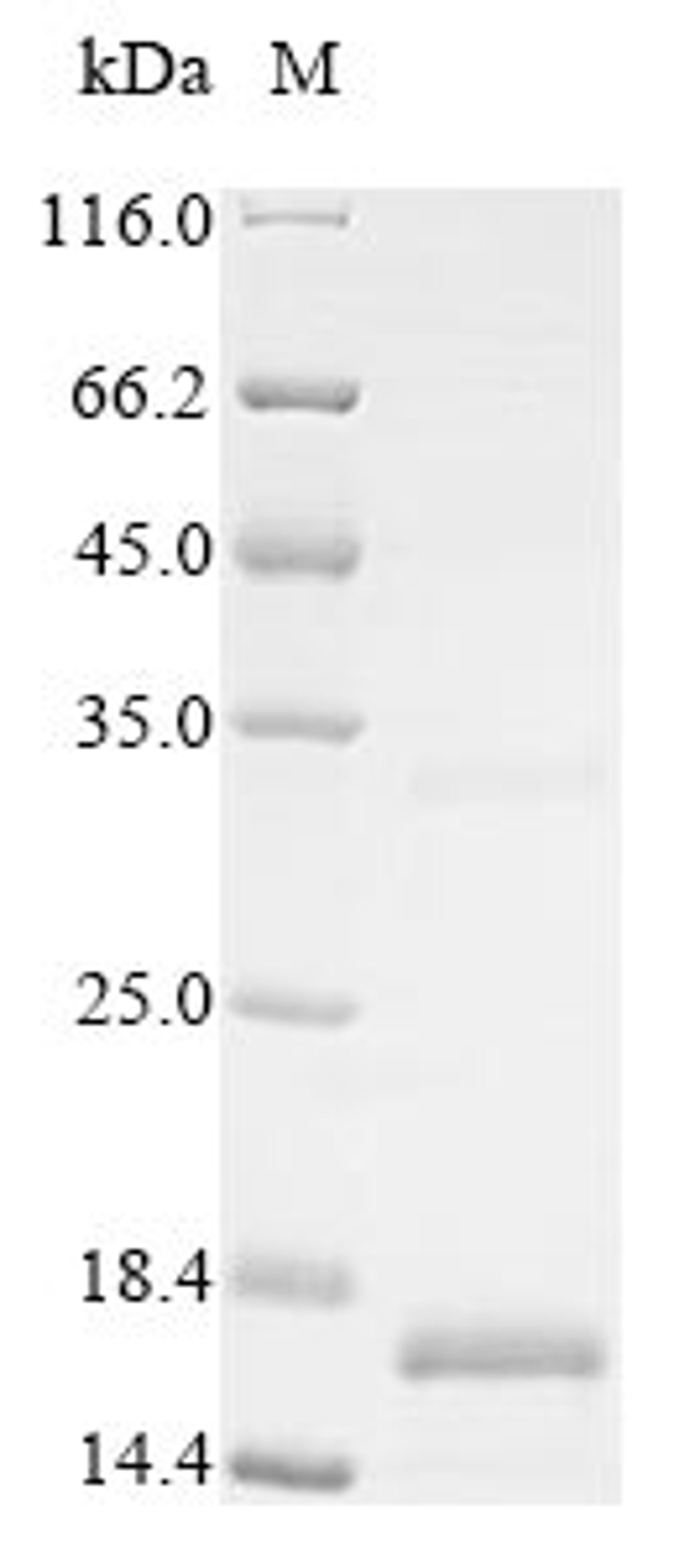 (Tris-Glycine gel) Discontinuous SDS-PAGE (reduced) with 5% enrichment gel and 15% separation gel.