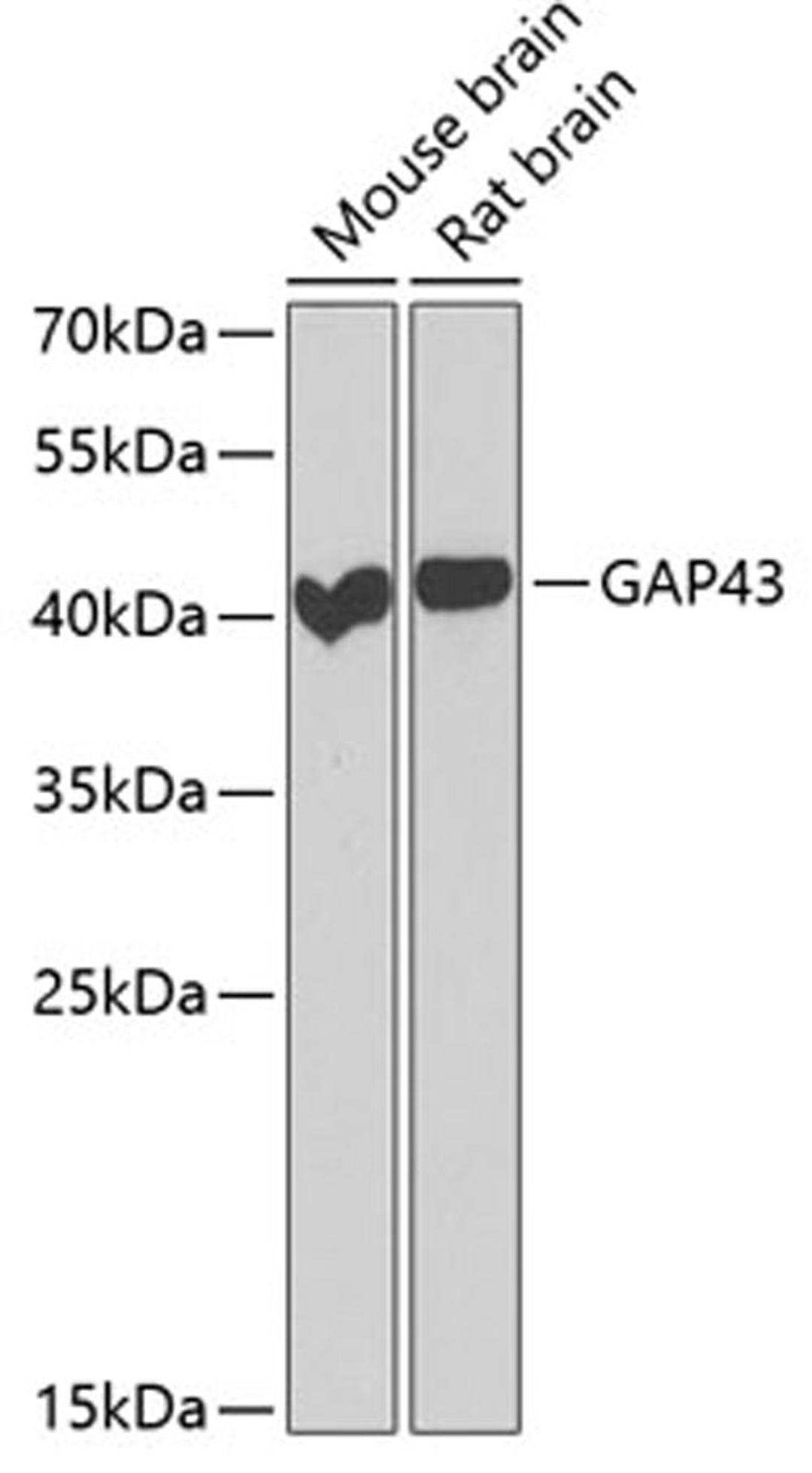 Western blot - GAP43 antibody (A6376)