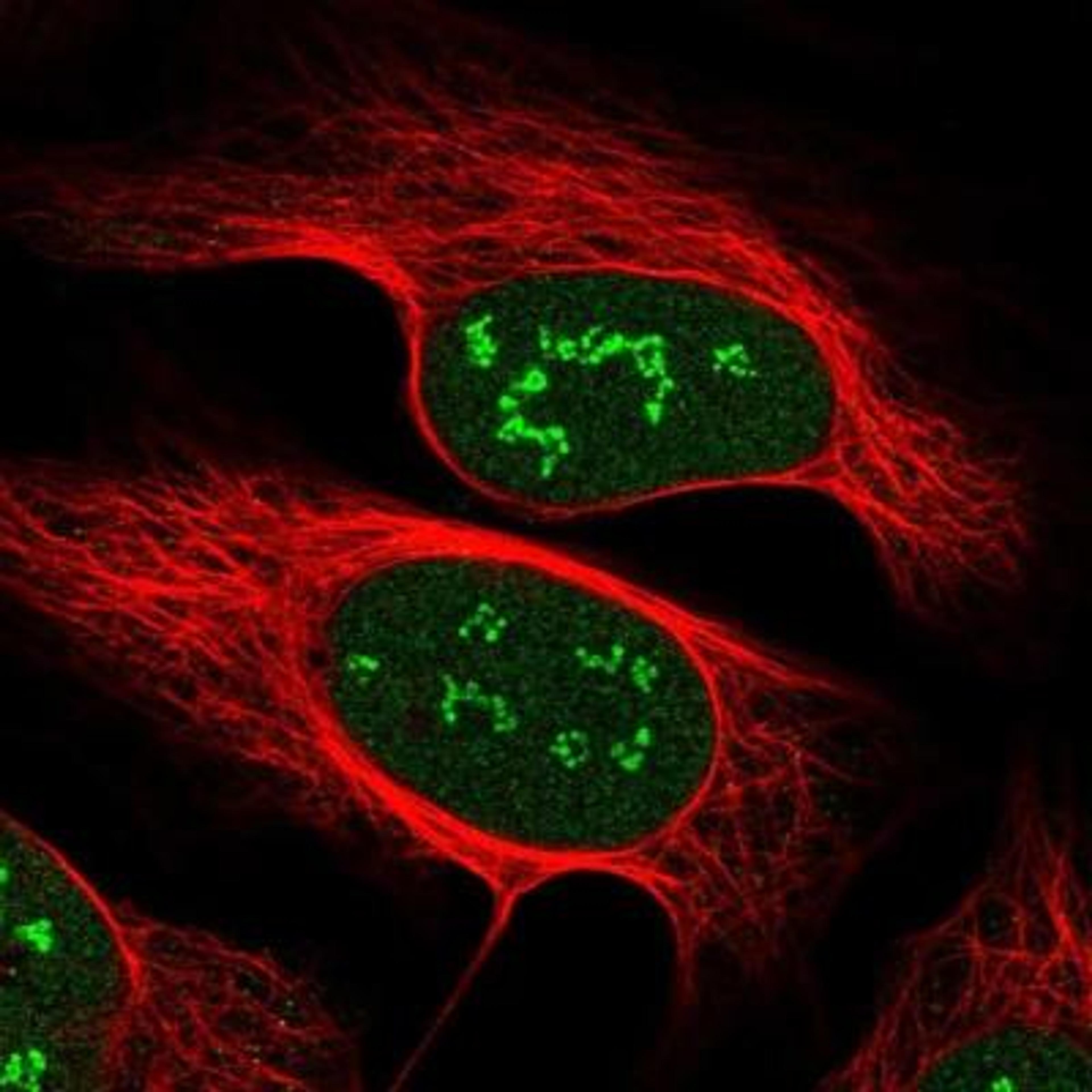 Immunocytochemistry/Immunofluorescence: VGLL4 Antibody [NBP1-81543] - Immunofluorescent staining of human cell line U-2 OS shows positivity in nucleus & nucleoli.