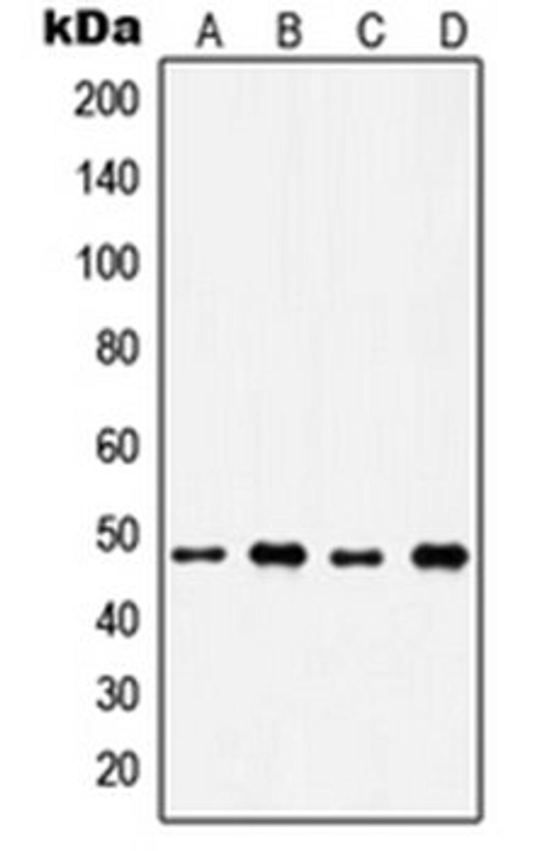 Western blot analysis of A549 (Lane 1), H1299 (Lane 2), HeLa (Lane 3), Raji (Lane 4) whole cell lysates using IP6K2 antibody