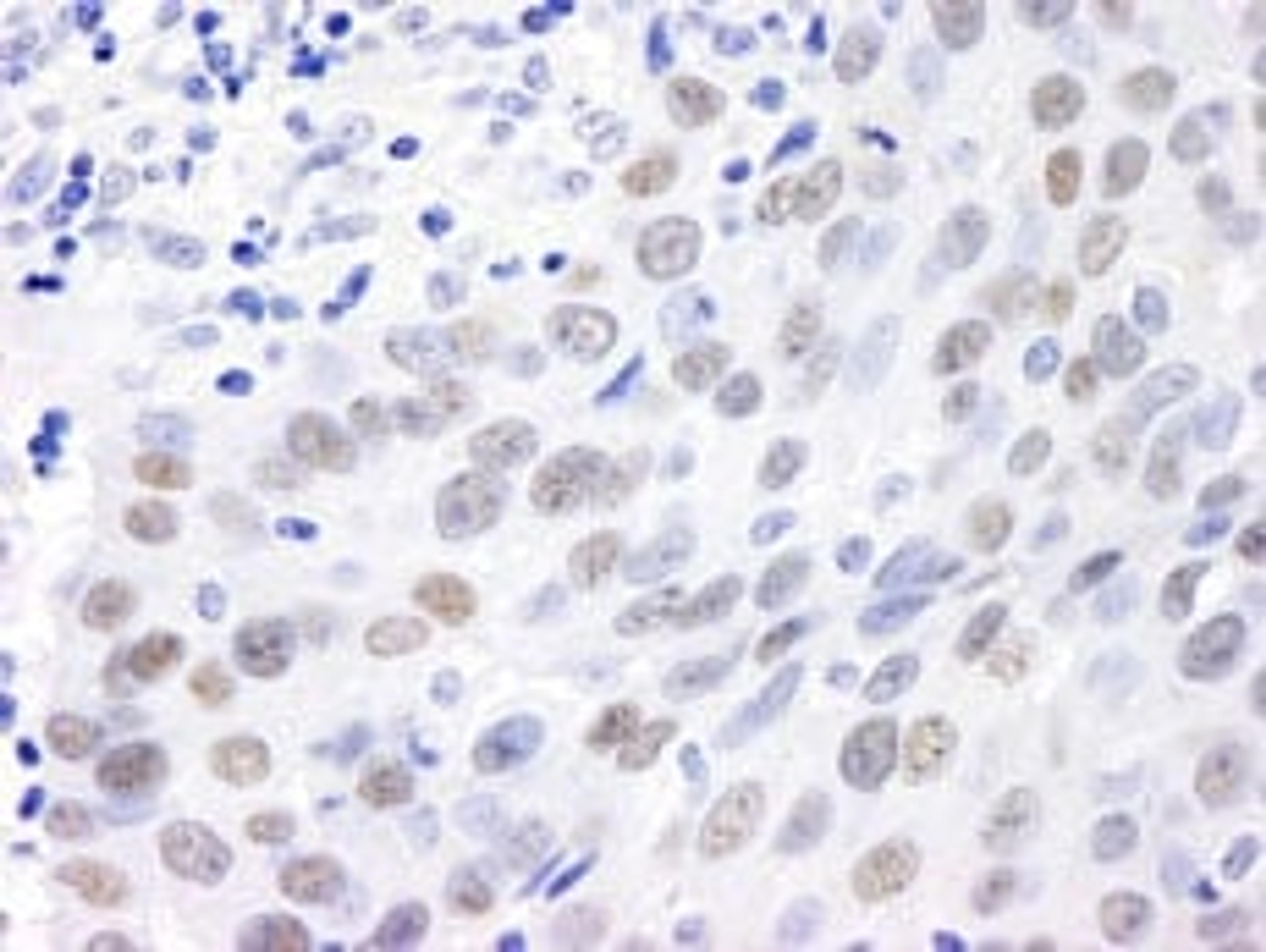 Detection of human MDC1 by immunohistochemistry.