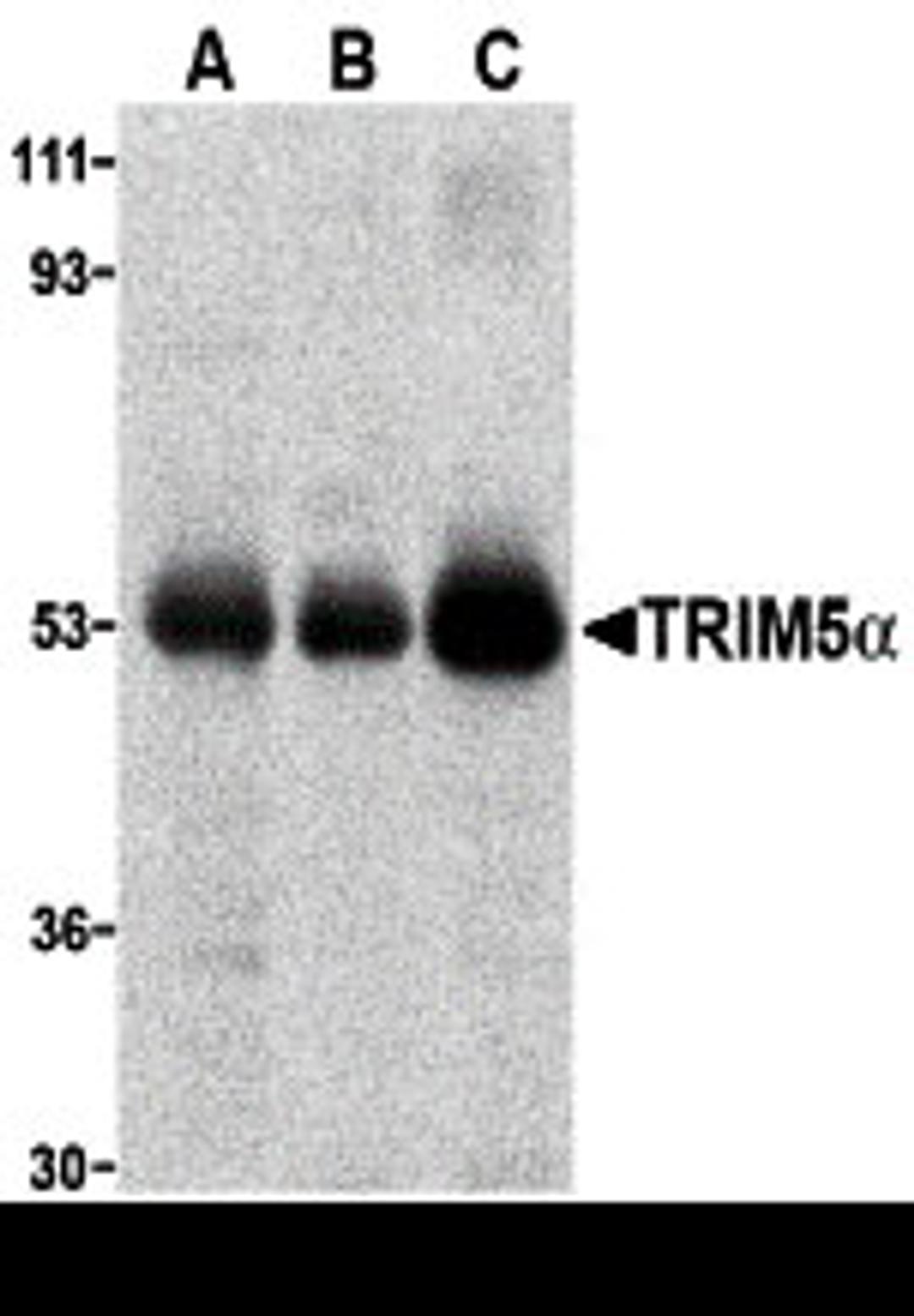 Western blot analysis of TRIM5 alpha expression in (A) human stomach, (B) thymus, and (C) uterus tissue lysate with TRIM5 alpha antibody at 2 μg/ml.