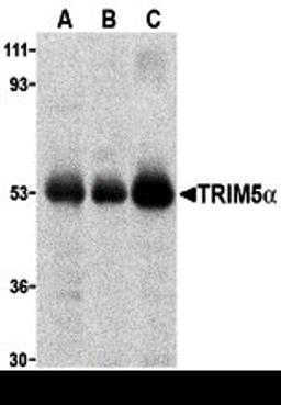 Western blot analysis of TRIM5 alpha expression in (A) human stomach, (B) thymus, and (C) uterus tissue lysate with TRIM5 alpha antibody at 2 μg/ml.