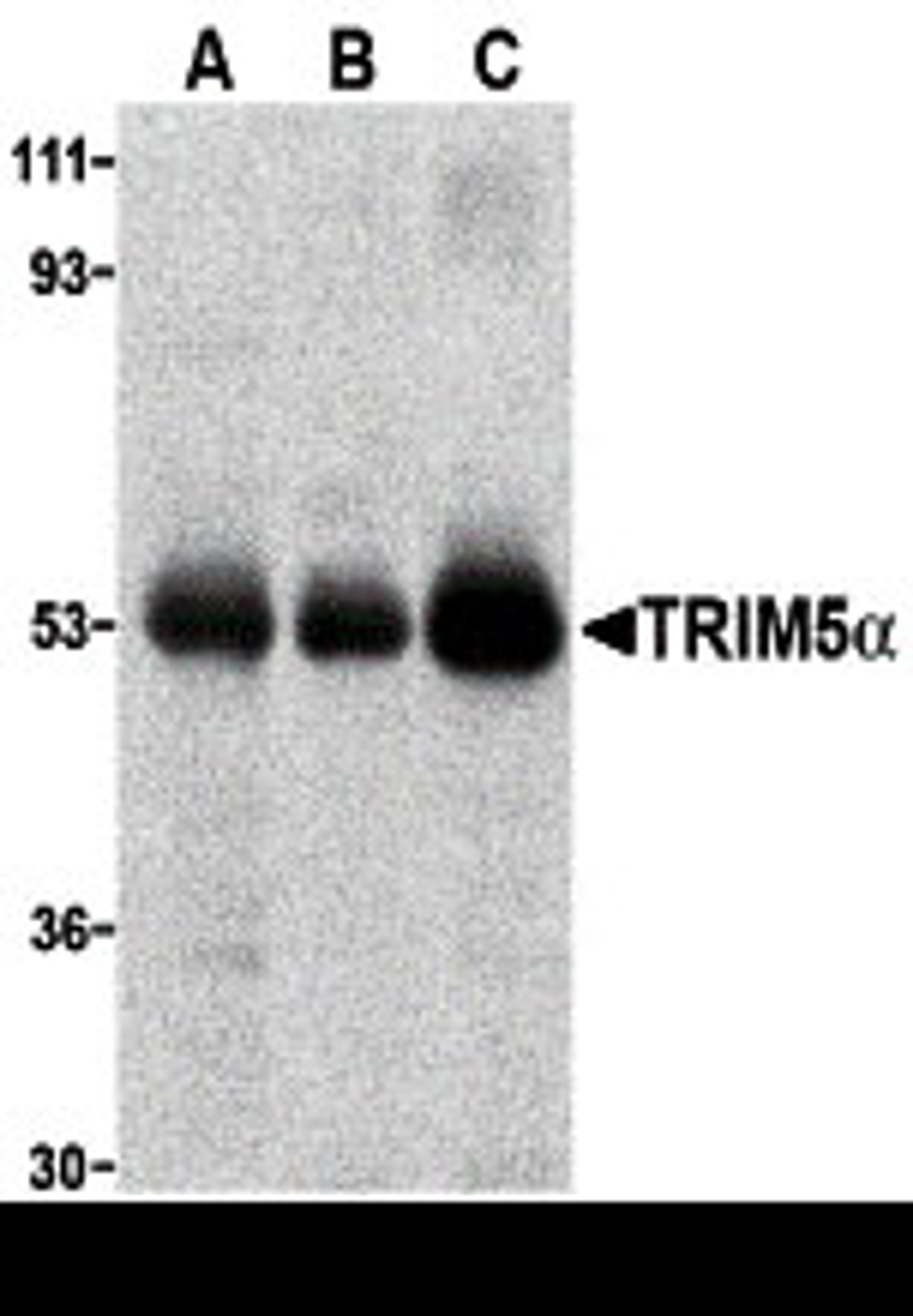 Western blot analysis of TRIM5 alpha expression in (A) human stomach, (B) thymus, and (C) uterus tissue lysate with TRIM5 alpha antibody at 2 μg/ml.