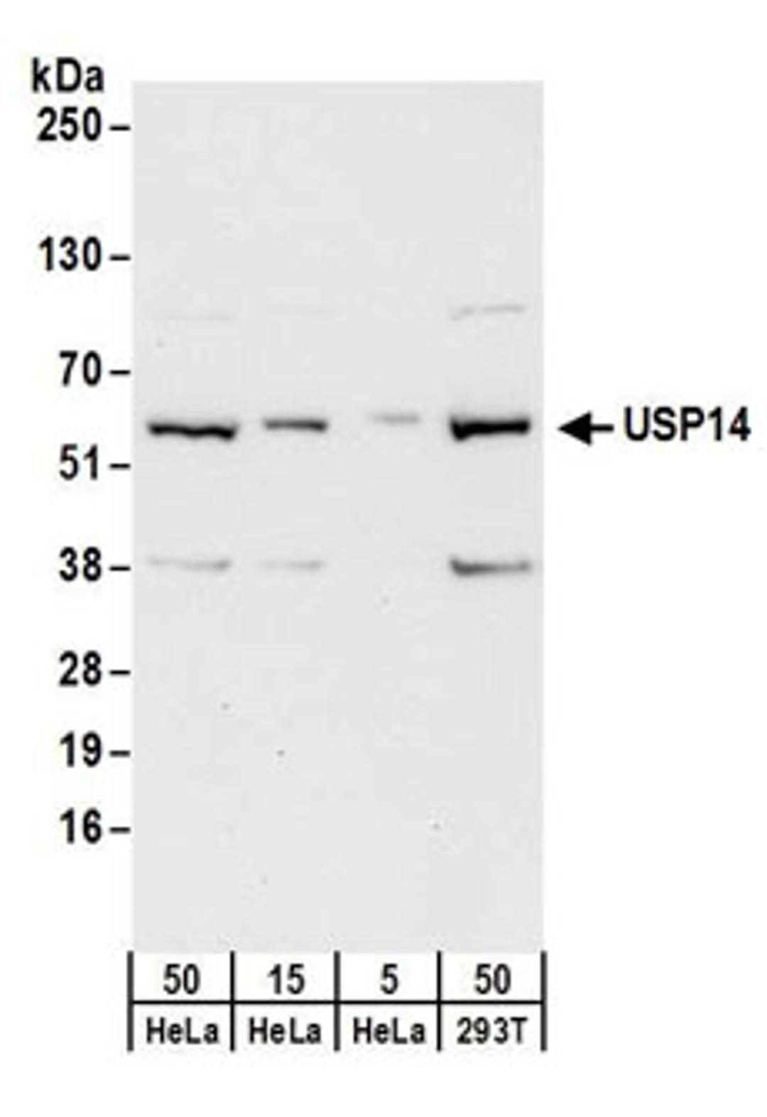 Detection of human USP14 by western blot.