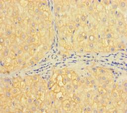 Immunohistochemistry of paraffin-embedded human liver tissue using CSB-PA010091LA01HU at dilution of 1:100