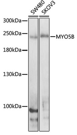 Western blot - MYO5B antibody (A8558)