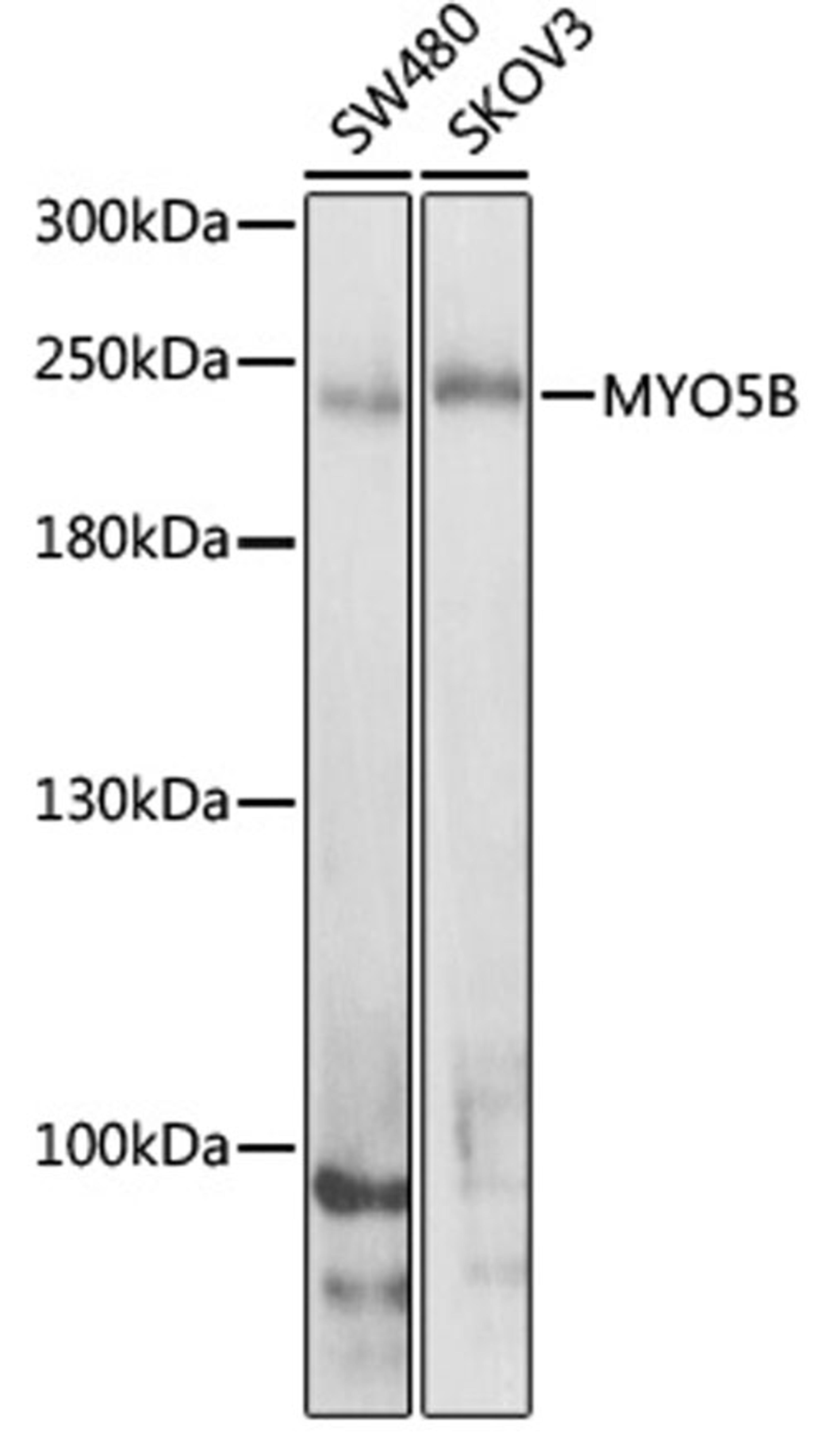 Western blot - MYO5B antibody (A8558)