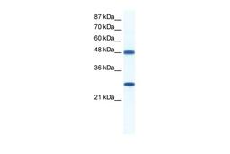 Antibody used in WB on Human Jurkat 0.2-1 ug/ml.