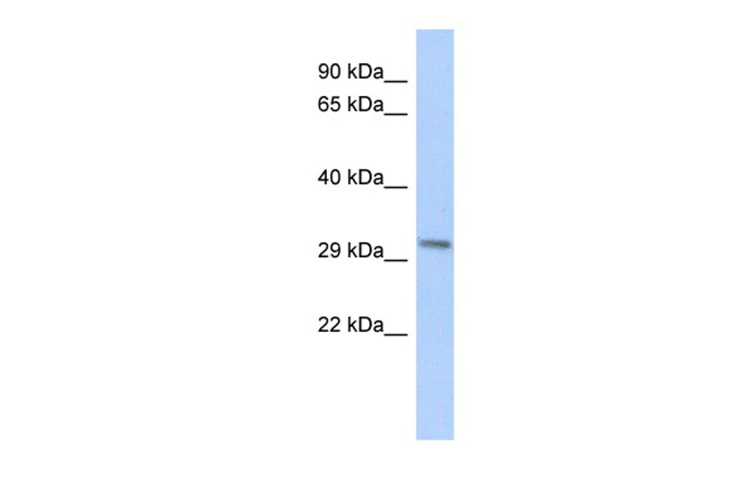 Antibody used in WB on Human Heart at 0.2-1 ug/ml.