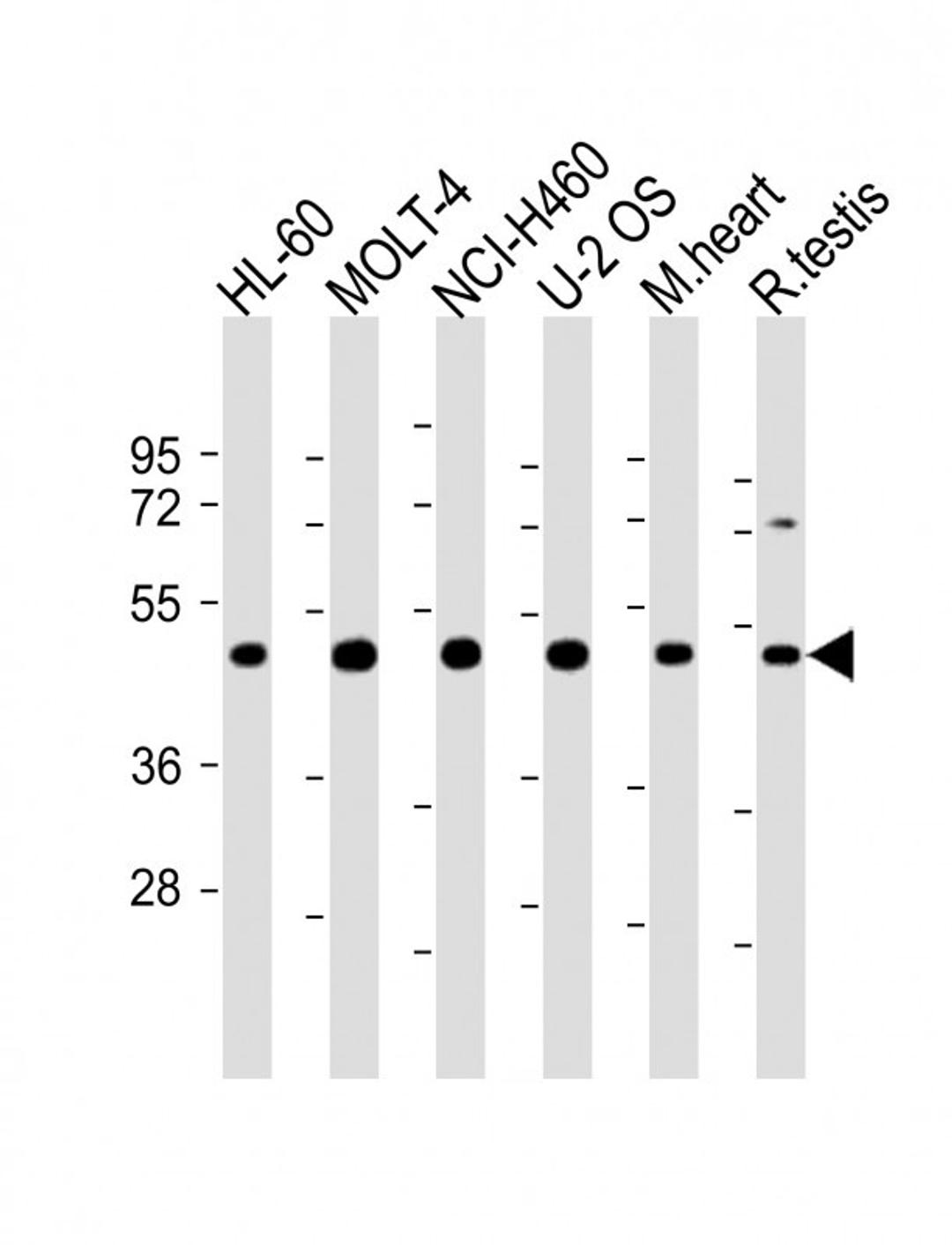 Western Blot at 1:2000 dilution Lane 1: HL-60 whole cell lysate Lane 2: MOLT-4 whole cell lysate Lane 3: NCI-H460 whole cell lysate Lane 4: U-2 OS whole cell lysate Lane 5: mouse heart lysate Lane 6: rat testis lysate Lysates/proteins at 20 ug per lane.