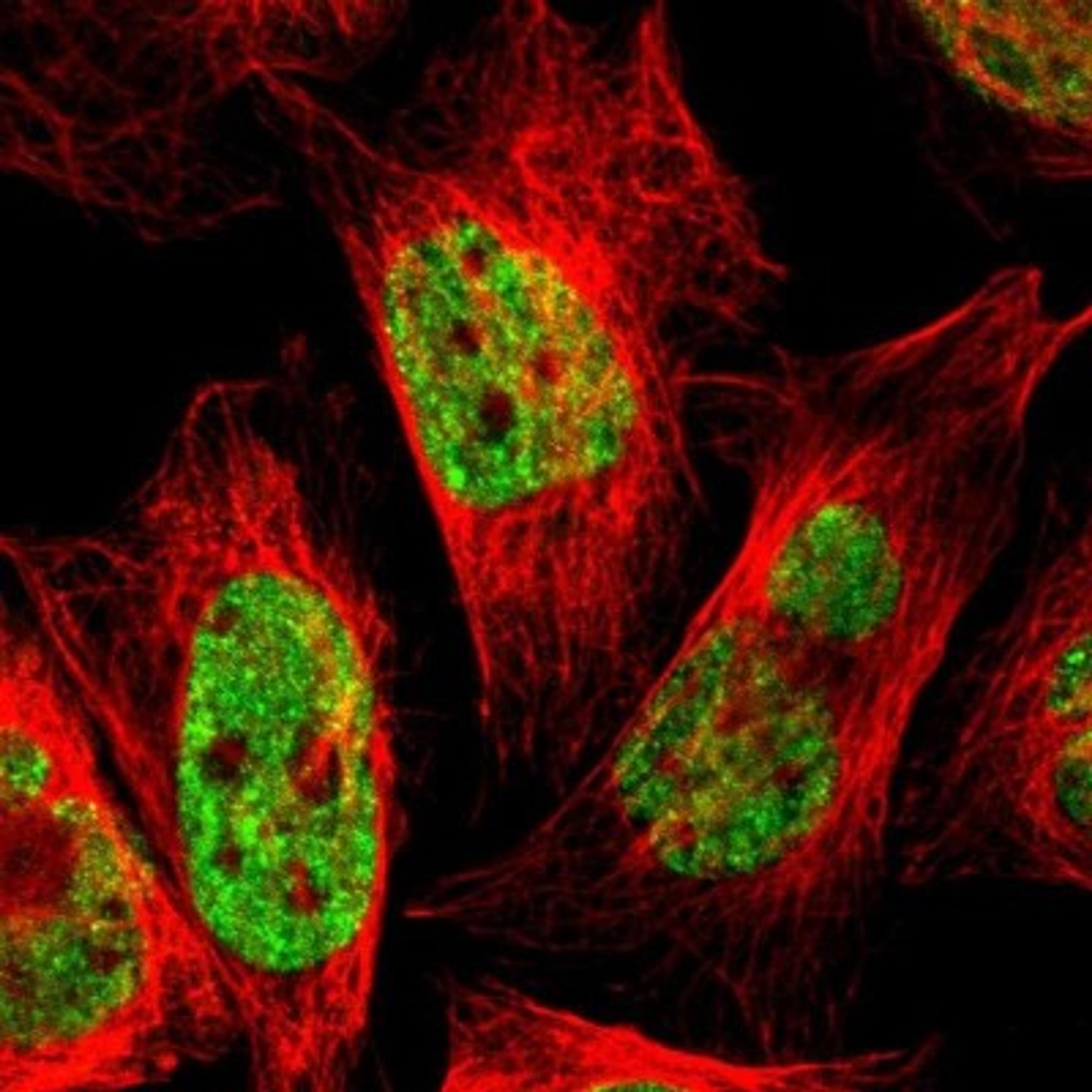 Immunocytochemistry/Immunofluorescence: MKL2 Antibody [NBP1-83535] - Staining of human cell line U-2 OS shows positivity in nucleus but not nucleoli.