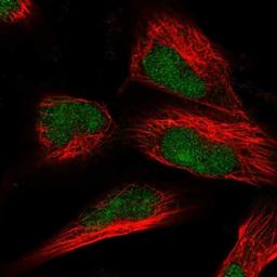 Immunocytochemistry/Immunofluorescence: FAM179A Antibody [NBP1-93765] - Staining of human cell line U-251 MG shows positivity in nucleus & nucleoli.