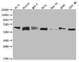 Western Blot. Positive WB detected in: PC3 whole cell lysate, Ntera-2 whole cell lysate, MCF-7 whole cell lysate, Hela whole cell lysate, HepG2 whole cell lysate, A549 whole cell lysate, U251 whole cell lysate. All lanes: USP14 antibody at 1:2000. Secondary. Goat polyclonal to rabbit IgG at 1/50000 dilution. Predicted band size: 57, 53, 55 kDa. Observed band size: 55-72 kDa. 