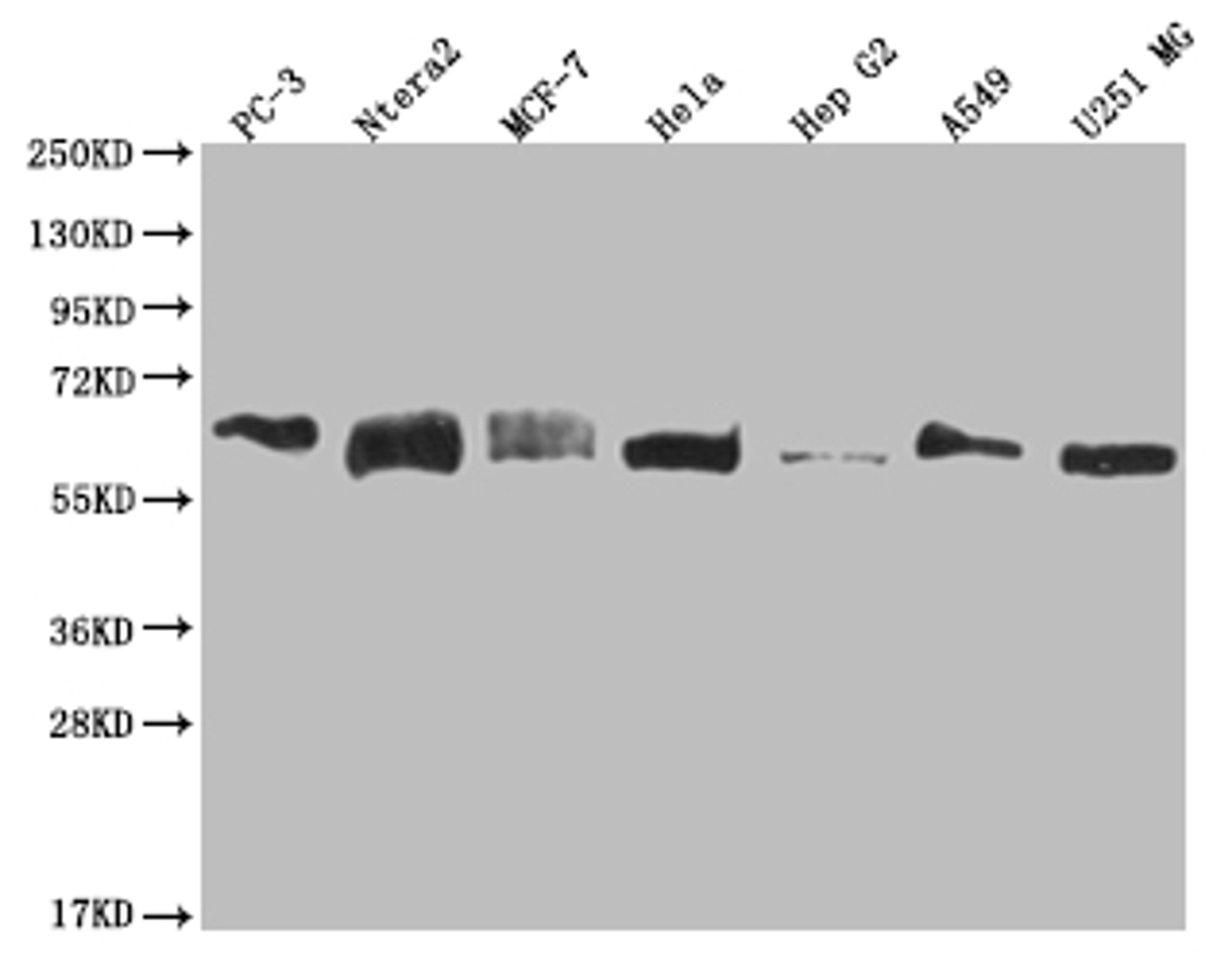 Western Blot. Positive WB detected in: PC3 whole cell lysate, Ntera-2 whole cell lysate, MCF-7 whole cell lysate, Hela whole cell lysate, HepG2 whole cell lysate, A549 whole cell lysate, U251 whole cell lysate. All lanes: USP14 antibody at 1:2000. Secondary. Goat polyclonal to rabbit IgG at 1/50000 dilution. Predicted band size: 57, 53, 55 kDa. Observed band size: 55-72 kDa. 