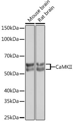 Western blot - CaMKII Rabbit mAb (A0198)