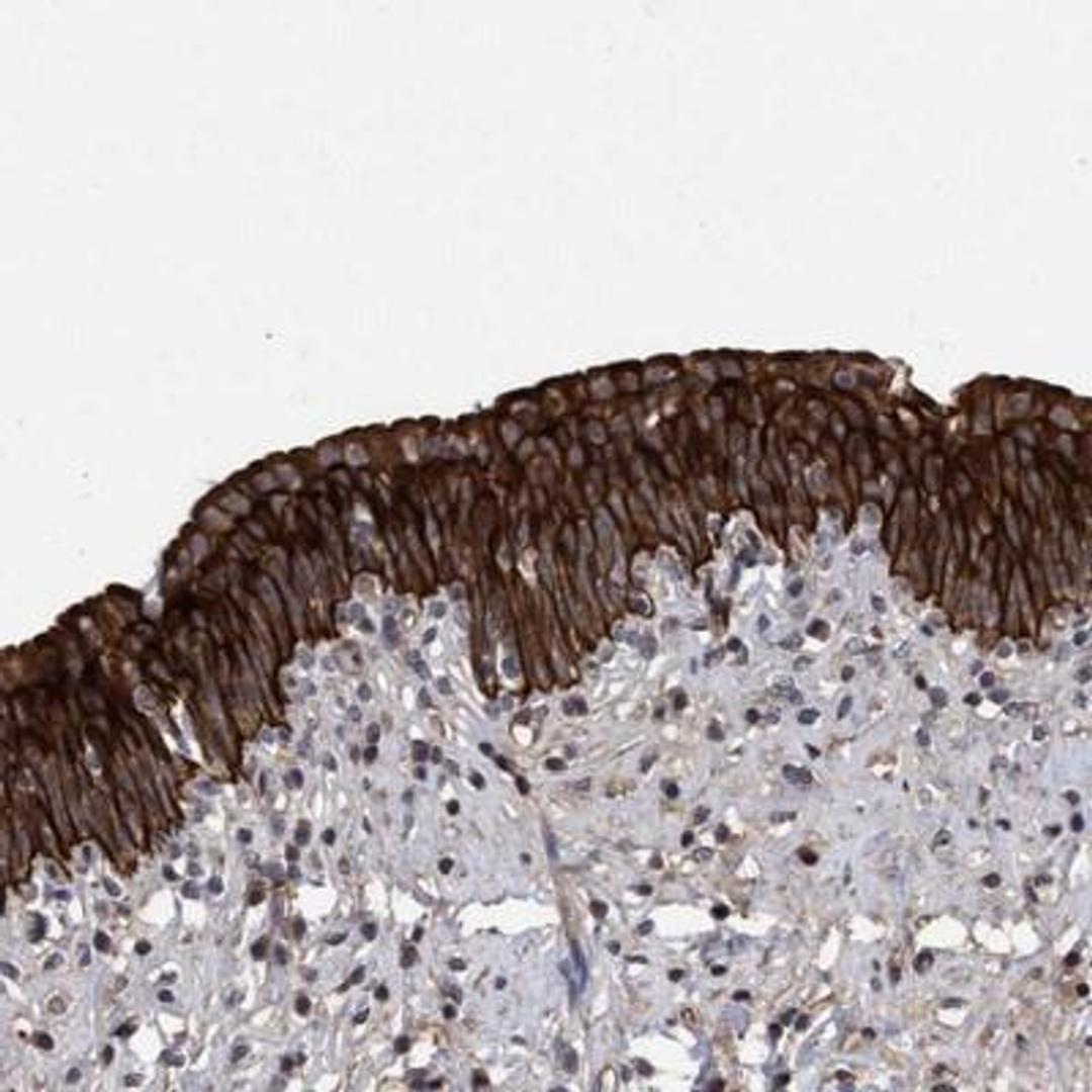 Immunohistochemistry: COBL Antibody [NBP1-89615] - Staining of human urinary bladder shows strong cytoplasmic and membranous positivity in urothelial cells.