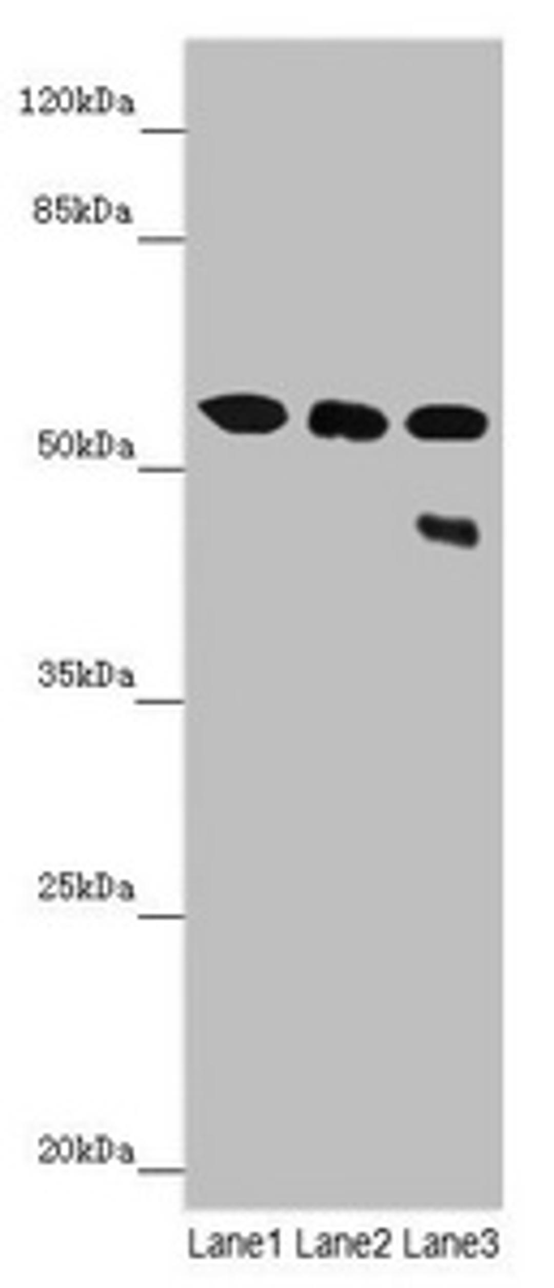 Western blot. All lanes: CYP3A43 antibody at 3.25 ug/ml. Lane 1: Mouse liver tissue. Lane 2: Mouse skeletal muscle tissue. Lane 3: 293T whole cell lysate. Secondary. Goat polyclonal to rabbit IgG at 1/10000 dilution. Predicted band size: 58, 49, 29, 45 kDa. Observed band size: 58, 45 kDa. 