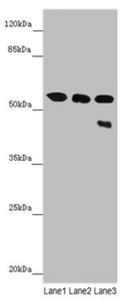 Western blot. All lanes: CYP3A43 antibody at 3.25 ug/ml. Lane 1: Mouse liver tissue. Lane 2: Mouse skeletal muscle tissue. Lane 3: 293T whole cell lysate. Secondary. Goat polyclonal to rabbit IgG at 1/10000 dilution. Predicted band size: 58, 49, 29, 45 kDa. Observed band size: 58, 45 kDa. 