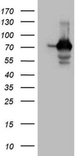 Immunohistochemistry: SSX2IP Antibody (5C3) [NBP2-45458] - Analysis of HEK293T cells were transfected with the pCMV6-ENTRY control (Left lane) or pCMV6-ENTRY SSX2IP.