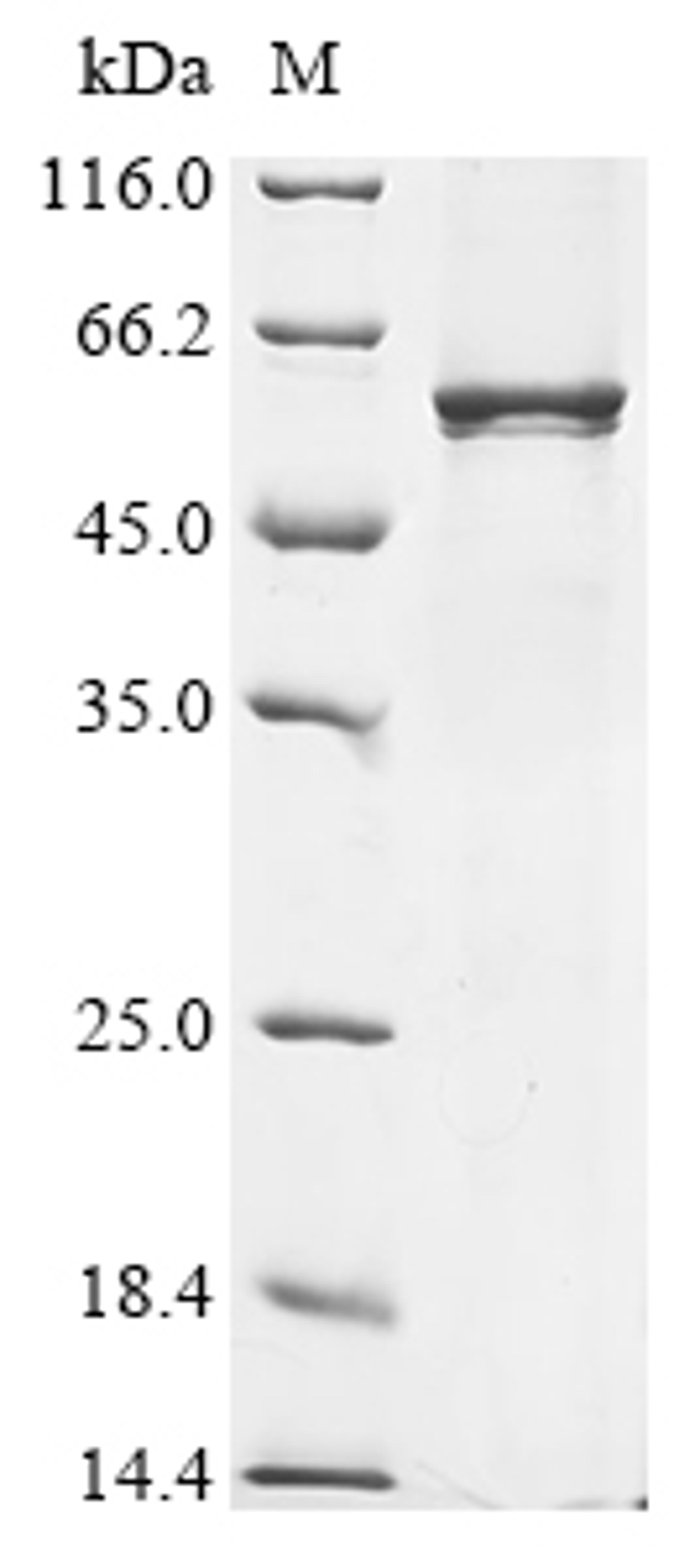 (Tris-Glycine gel) Discontinuous SDS-PAGE (reduced) with 5% enrichment gel and 15% separation gel.