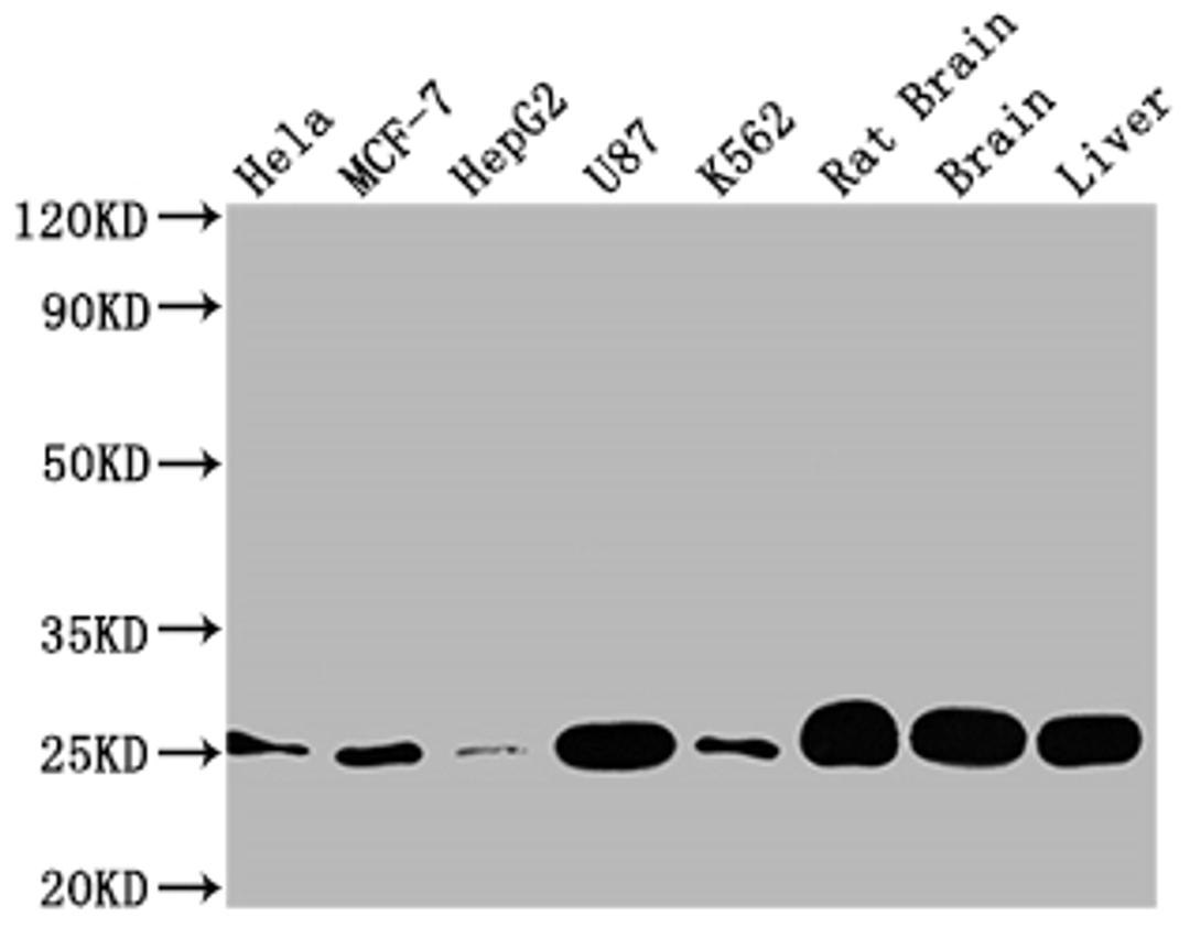 Western Blot. Positive WB detected in: Hela whole cell lysate, MCF-7 whole cell lysate, HepG2 whole cell lysate, U87 whole cell lysate, K562 whole cell lysate, Rat brain tissue, Brain tissue, Liver tissue. All lanes: SOD2 antibody at 1:2000. Secondary. Goat polyclonal to rabbit IgG at 1/50000 dilution. Predicted band size: 25, 21, 19, 20 kDa. Observed band size: 25 kDa. 