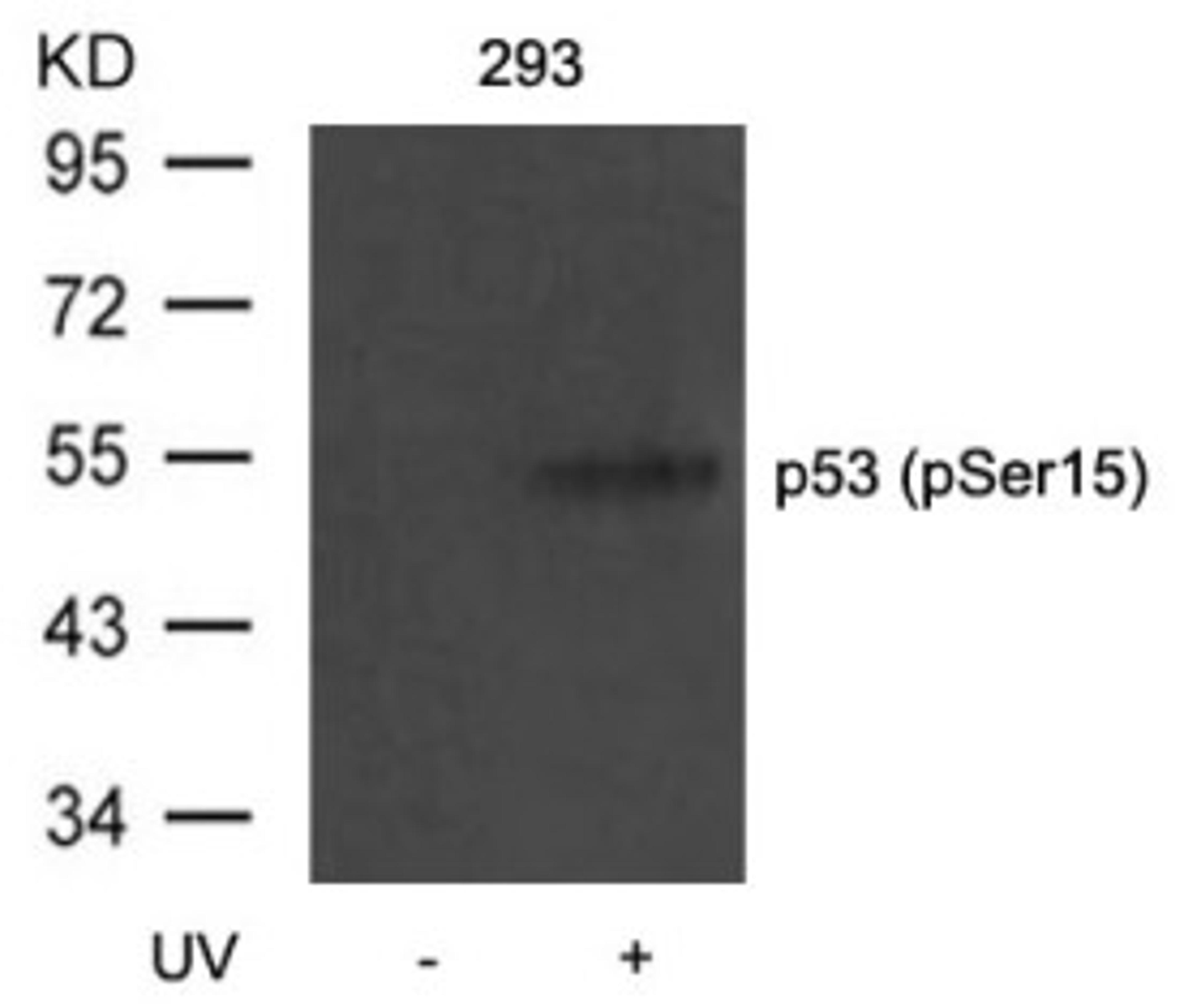 Western blot analysis of lysed extracts from 293 cells untreated or treated with UV using p53 (Phospho-Ser15).