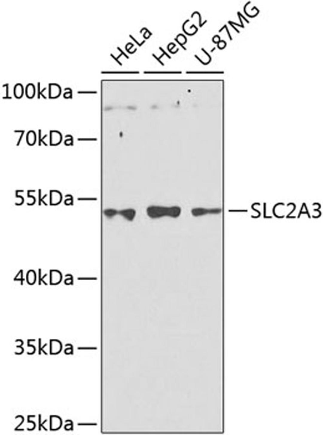 Western blot - GLUT3 Antibody (A8150)