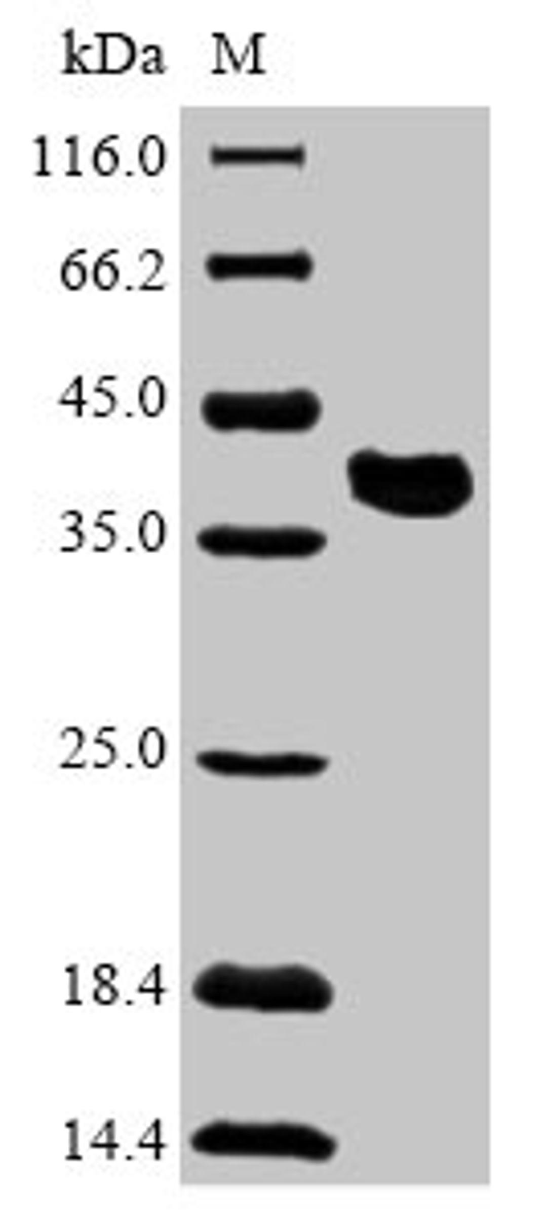 (Tris-Glycine gel) Discontinuous SDS-PAGE (reduced) with 5% enrichment gel and 15% separation gel.