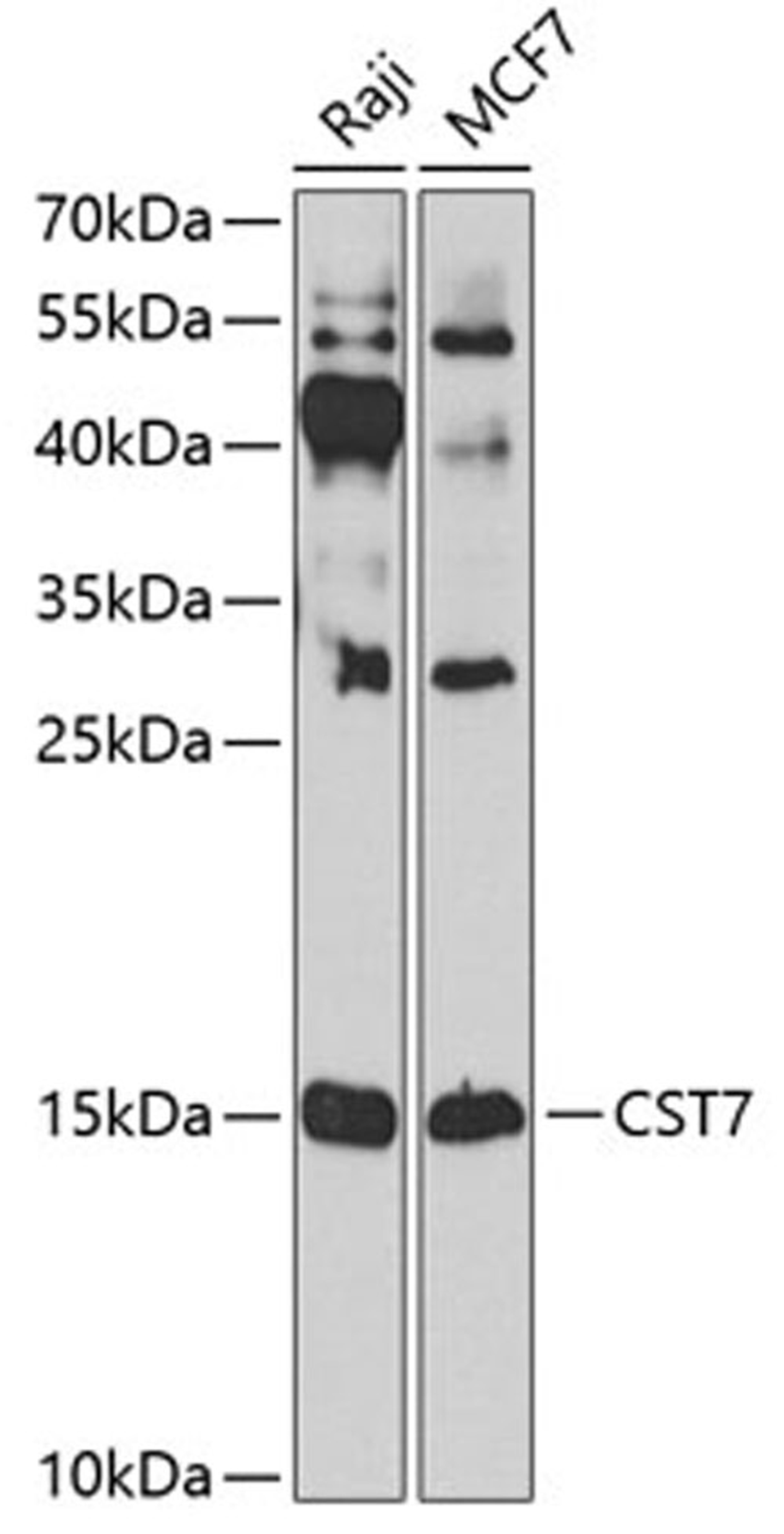 Western blot - CST7 antibody (A8164)