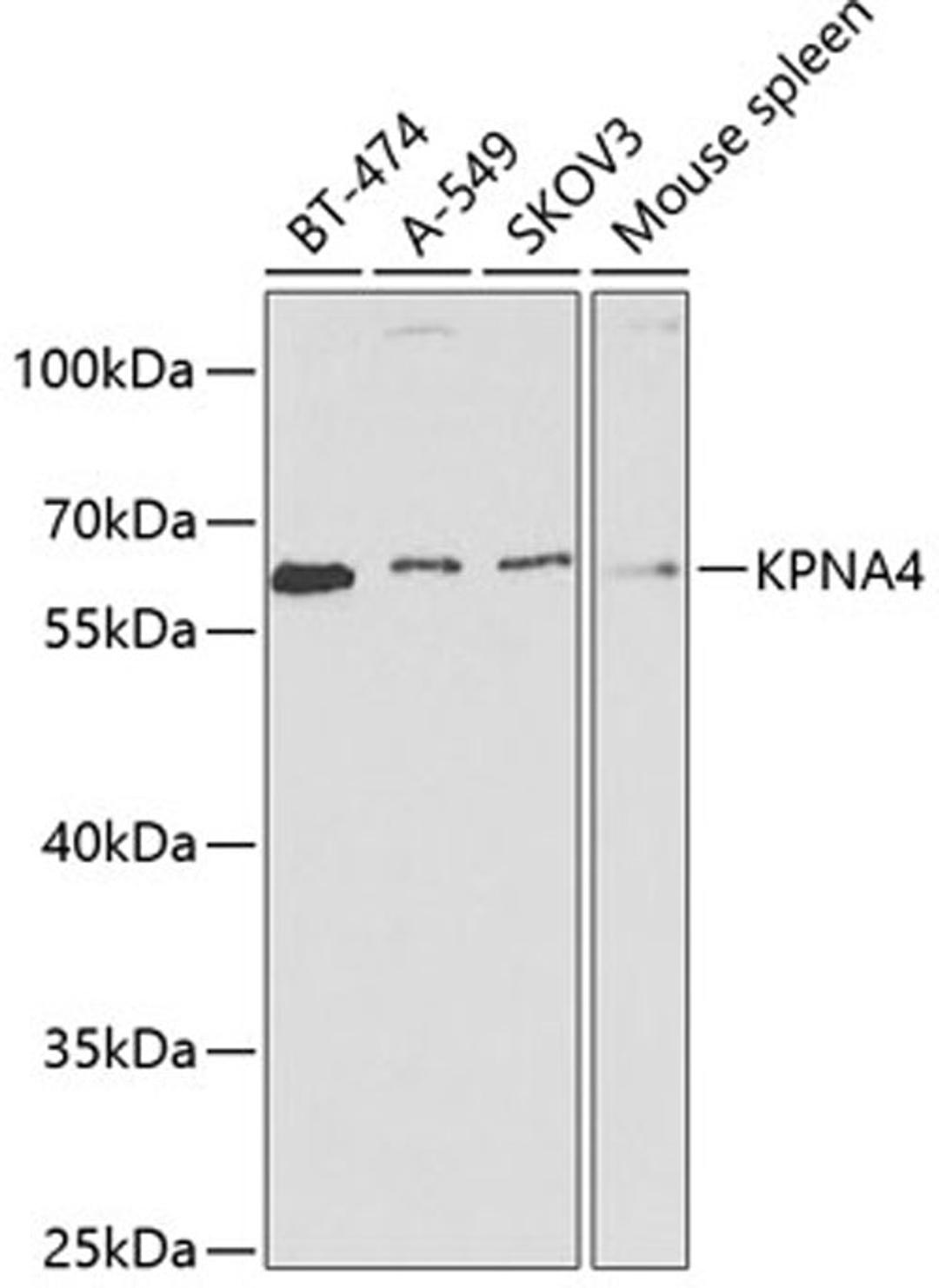 Western blot - KPNA4 antibody (A2026)